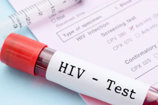 Osasco terá pontos de testagem de HIV e Sífilis